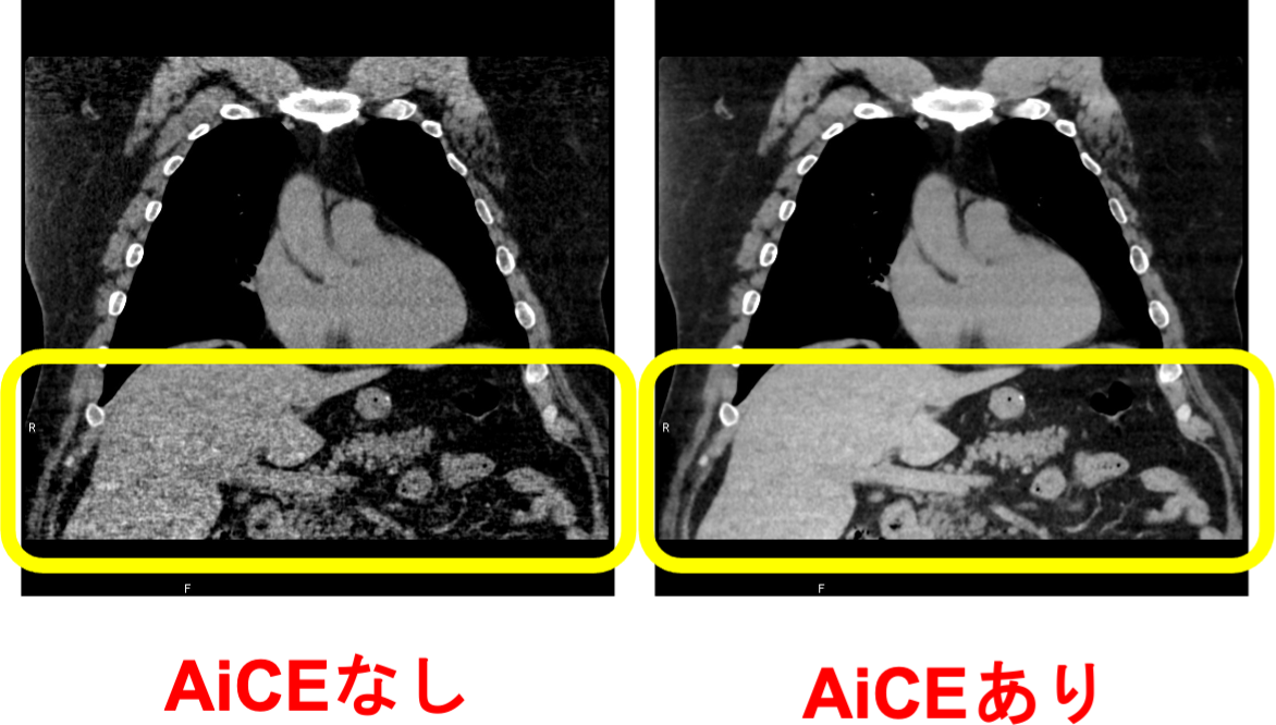 AiCEなしとAiCEありの画像比較