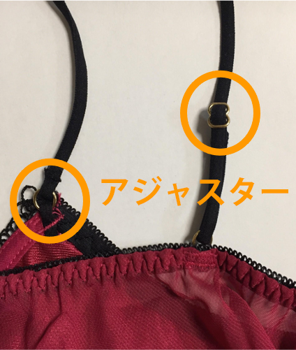 Philips 体内インプラント画像