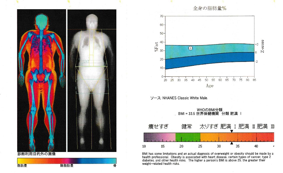 全身骨測定・体組織測定