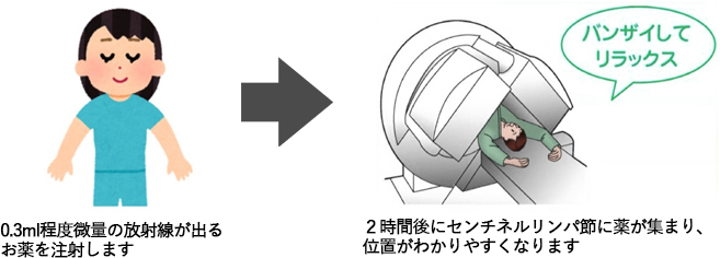 センチネルリンパ節シンチグラフィ