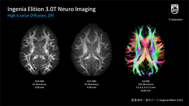 MRI画像（GE社 Philips社 提供）1