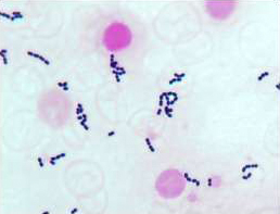 *グラム陽性球菌（連鎖状）