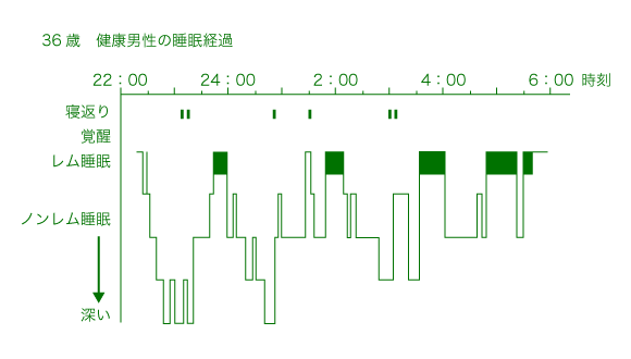 36歳　健康男性の睡眠経過