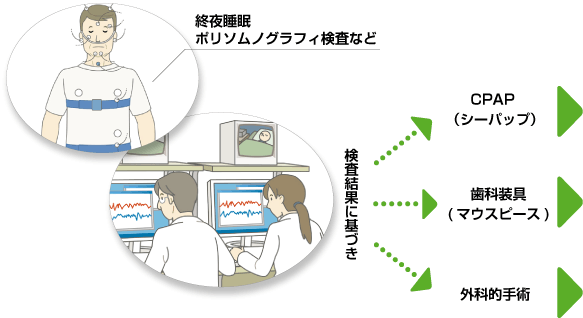 終夜睡眠ポリグラフ検査など
検査結果に基づき
	・CPAP(シーパップ)
	・歯科装具(マウスピース)
	・外科的手術